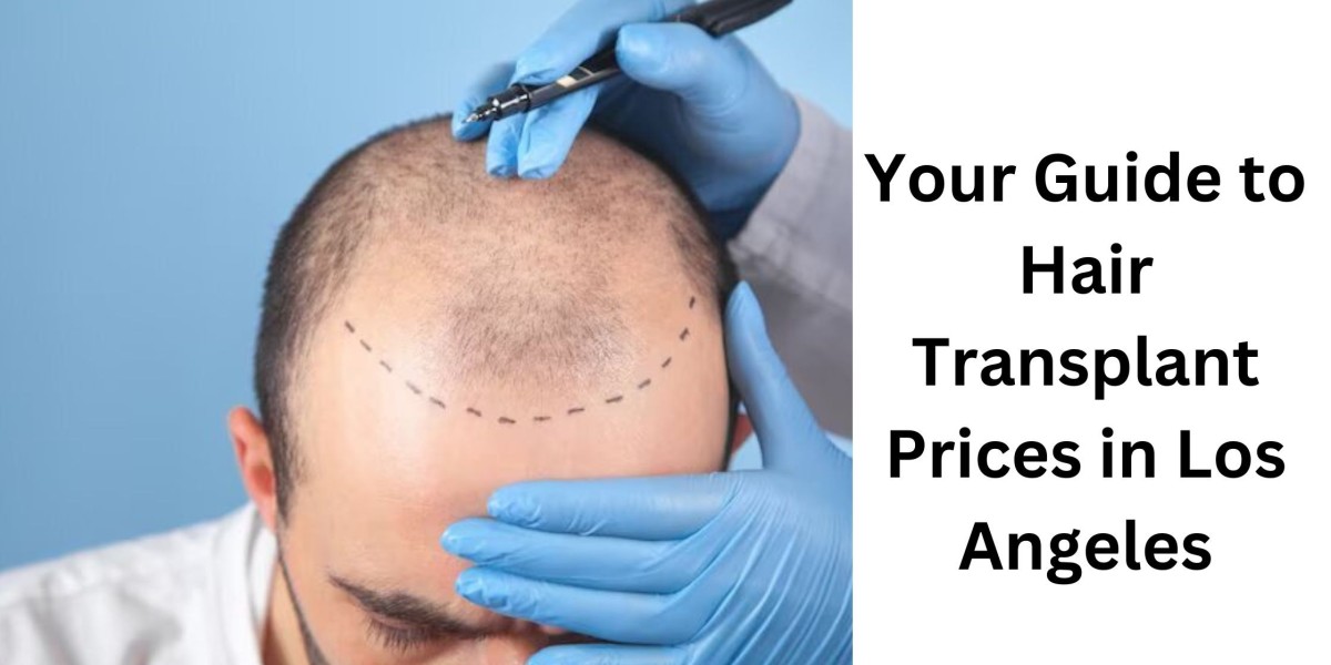 Your Guide to Hair Transplant Prices in Los Angeles