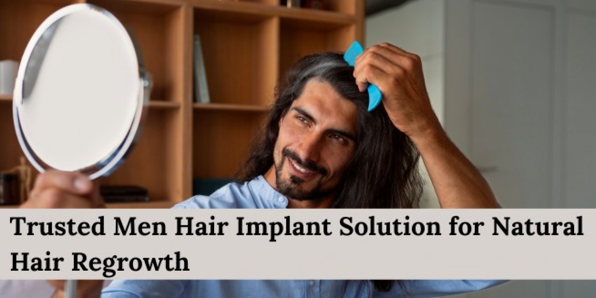 Trusted Men Hair Implant Solution for Natural Hair Regrowth