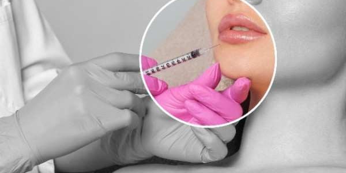 Smile Framing: Why Lip Shape Matters in Dentistry