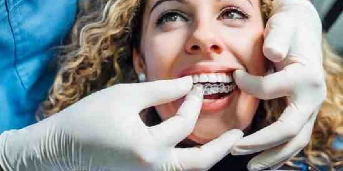 Invisalign Treatment Planning and Outcomes