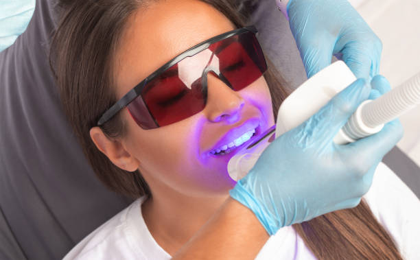 Zoom Whitening For Your Teeth – How Does it Work? | LogCla.com