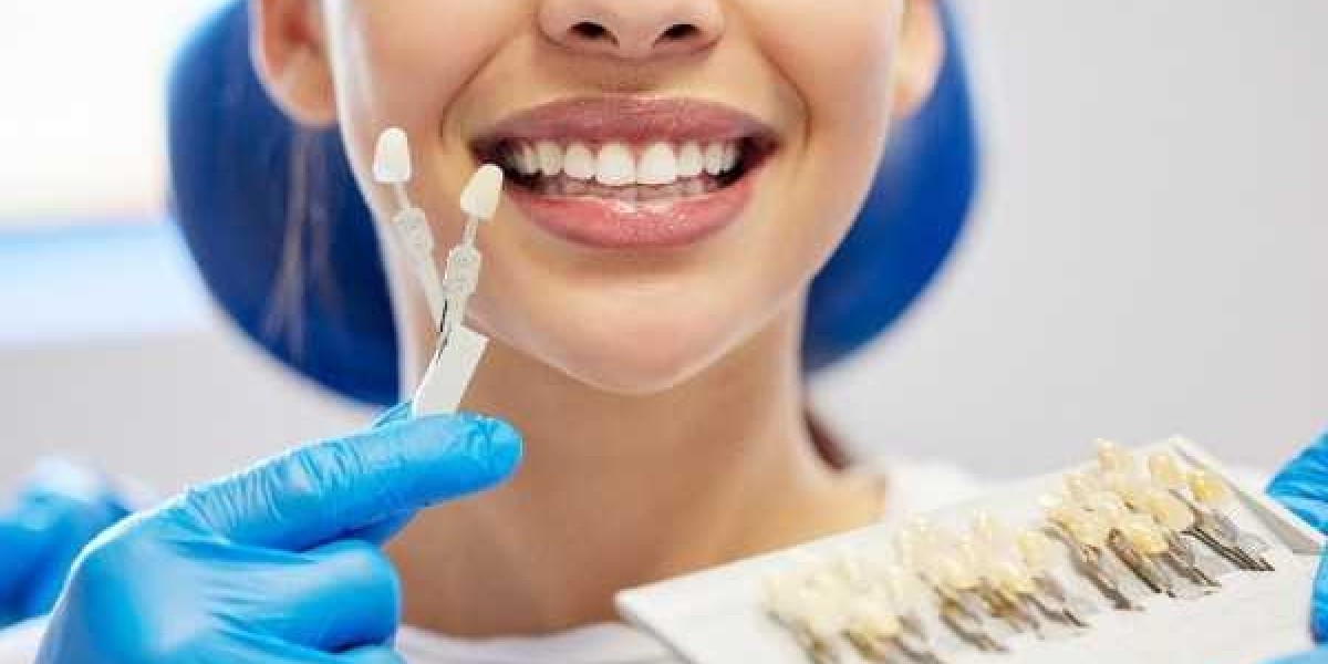 Specialist in Cosmetic Tooth Whitening Solutions