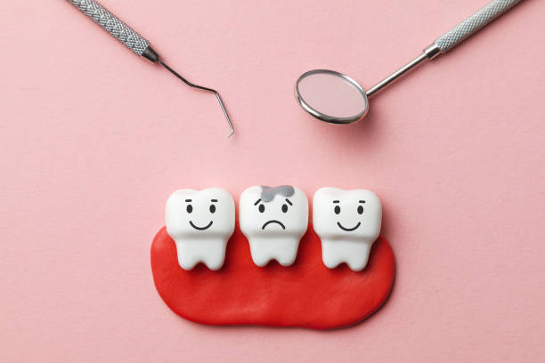 How to Repair Damaged Teeth Using Inlays and Onlays? | LogCla.com