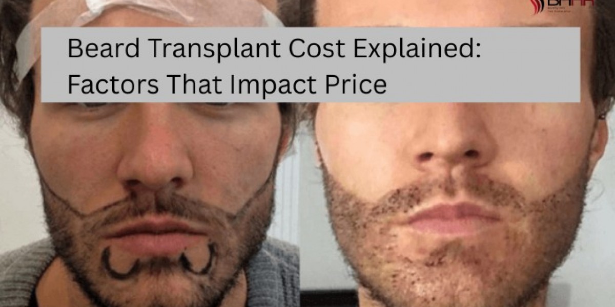 Beard Transplant Cost Explained: Factors That Impact Price