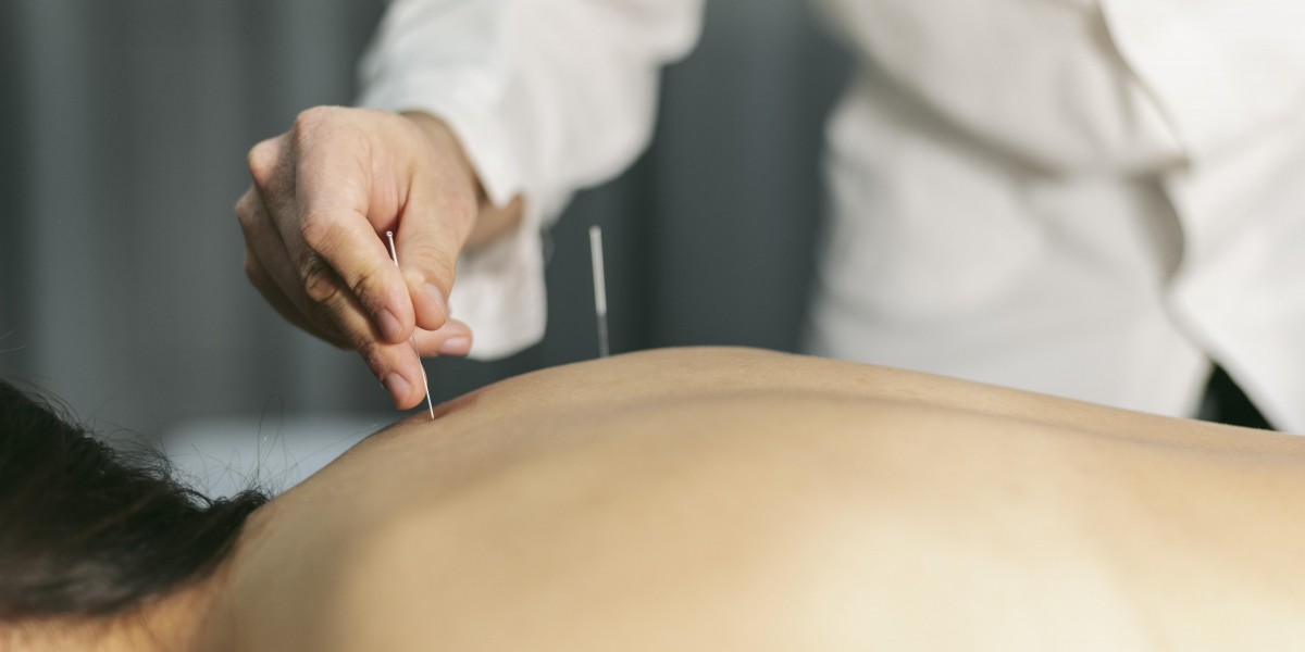 Unlocking Your Path To Parenthood: How Acupuncture Boosts Fertility