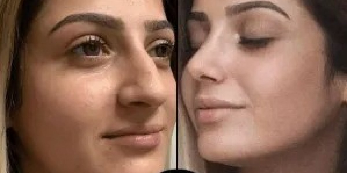 Who Are the Best Plastic Surgeons in Dubai? Full List 2025