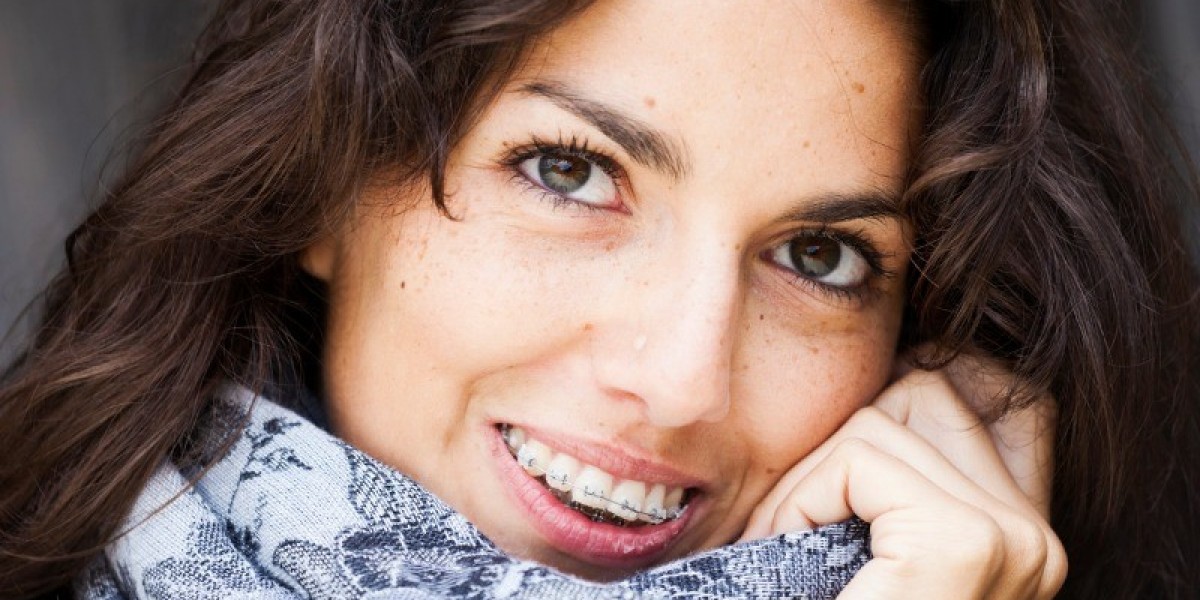 10 Common Myths About Braces and Aligners – Busted by Experts!