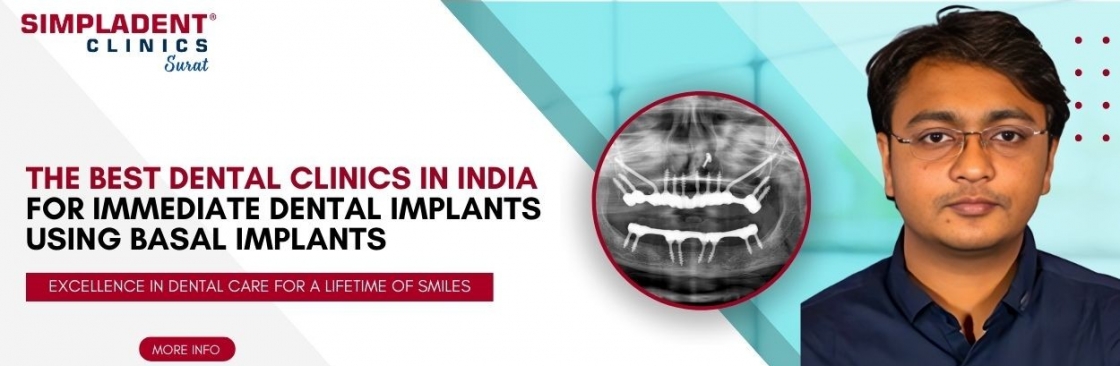Full Mouth Dental Implant in Surat Full Mouth Dental Implants Surge Cover Image