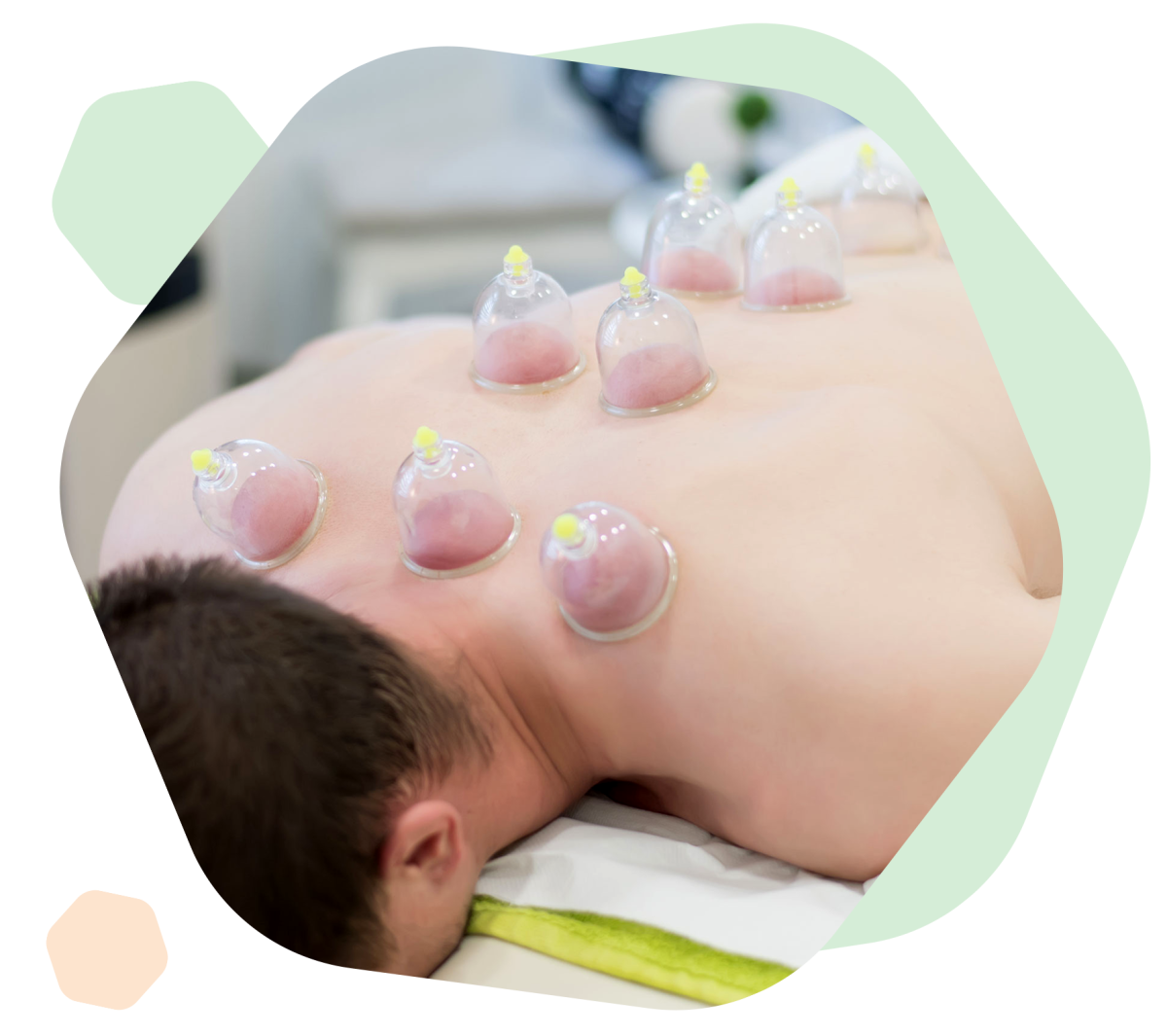 Cosmetic Acupuncture Calgary and Wrong Prejudices You Must Be Aware of | by J | Oct, 2025 | Medium