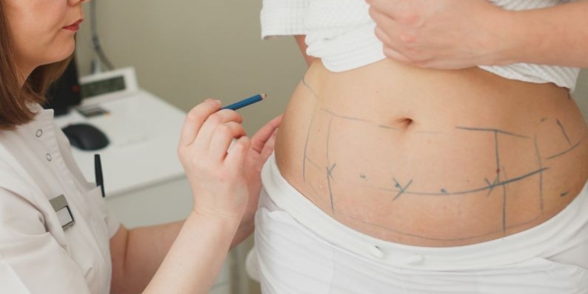 Sculpt Your Waist with Abdominoplasty in Islamabad