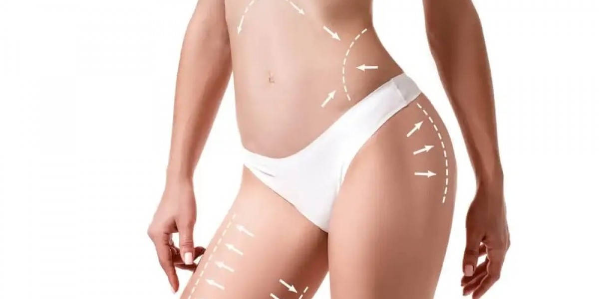 Laser Liposuction Recovery: Tips for Faster Healing