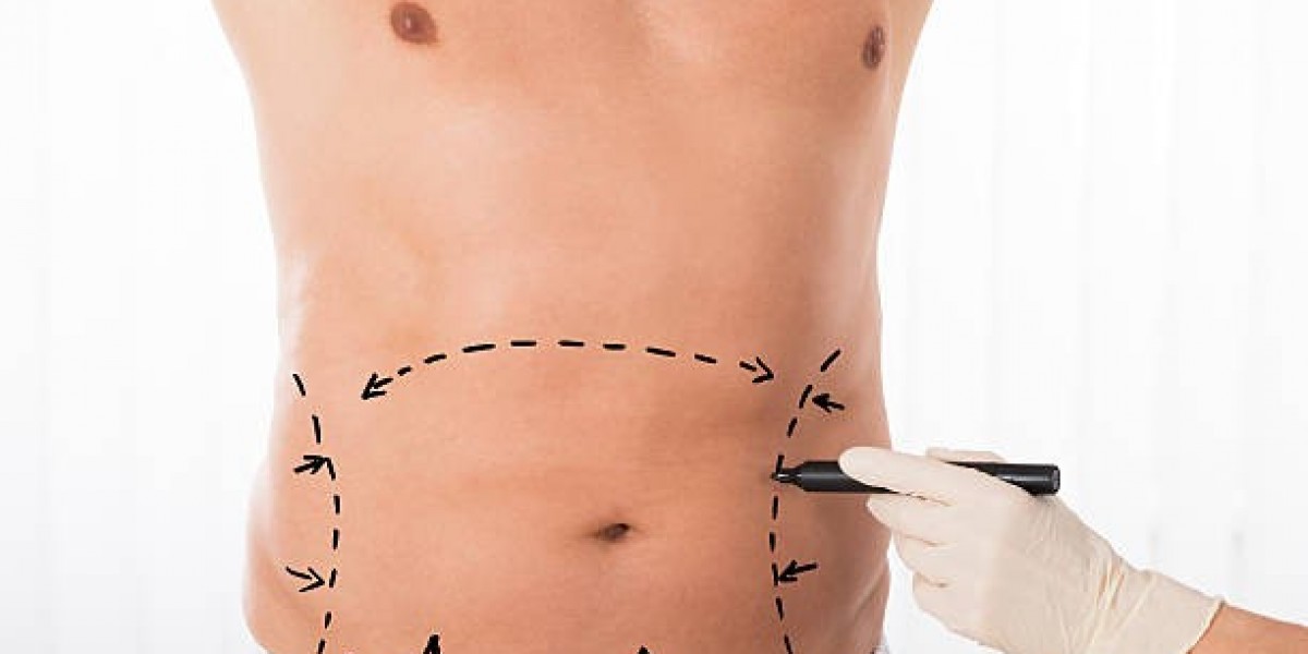 Fat Melting Injections Explained: Benefits, Process, and Results