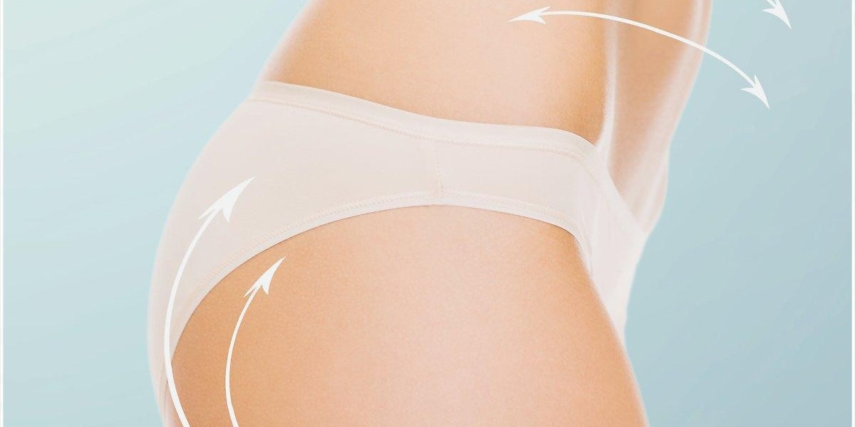 Liposuction in Riyadh vs Traditional Methods: Which Delivers Better Results