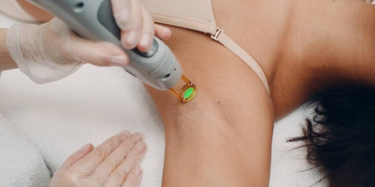 Home Prep Tips for Electrolysis Hair Removal Success