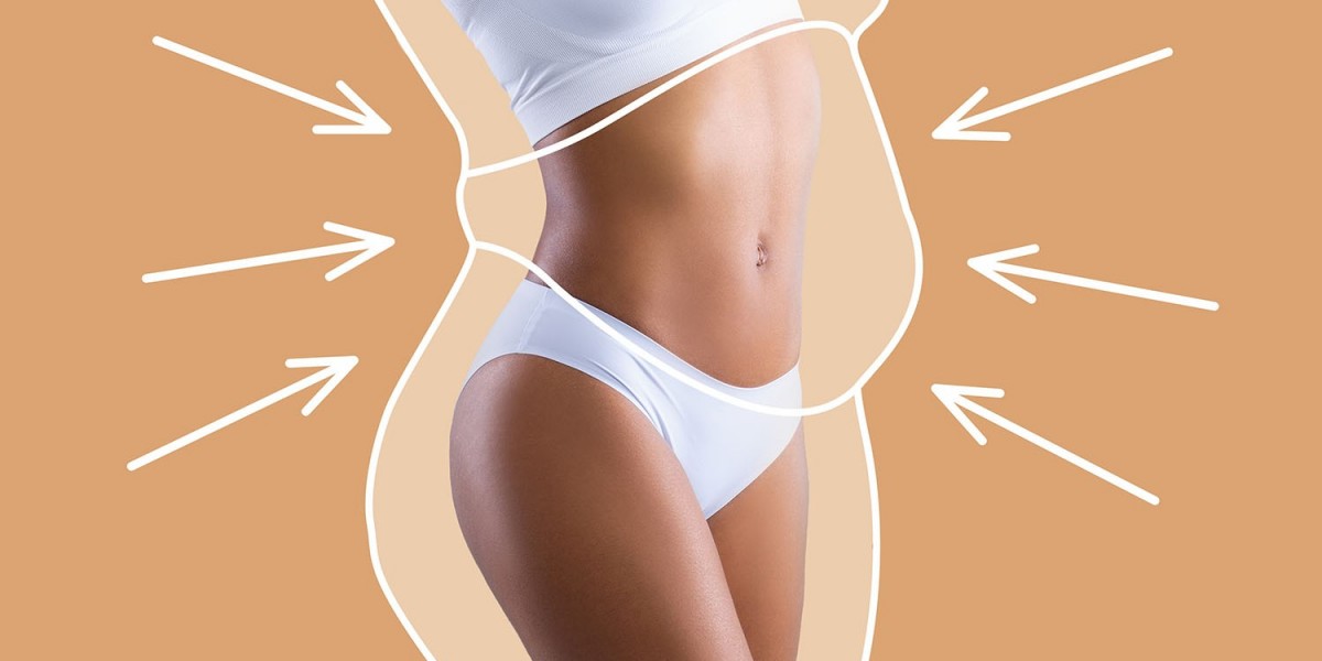 SmartLipo Explained: Why People Choose Laser-Assisted Fat Removal