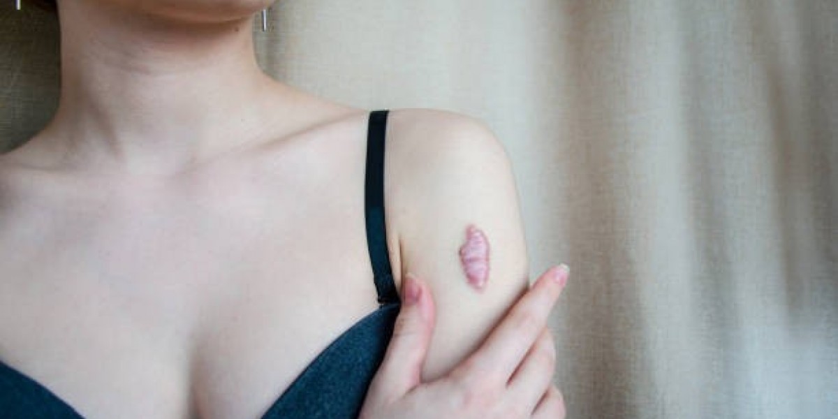 Laser Scar Removal for Uneven Skin Tone and Texture