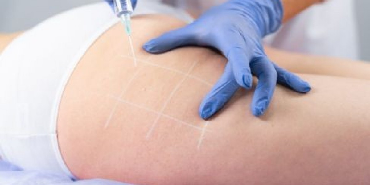 Body Butt Fillers vs Traditional Enhancement Methods