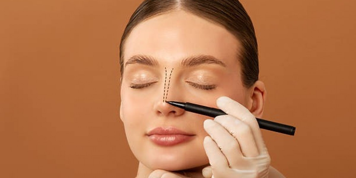 A Complete Guide to Rhinoplasty for Natural-Looking Results