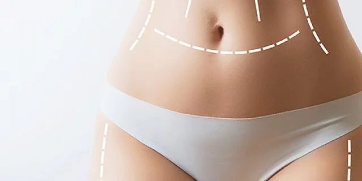Body Sculpting Procedure Before and After: Stunning Transformations Await