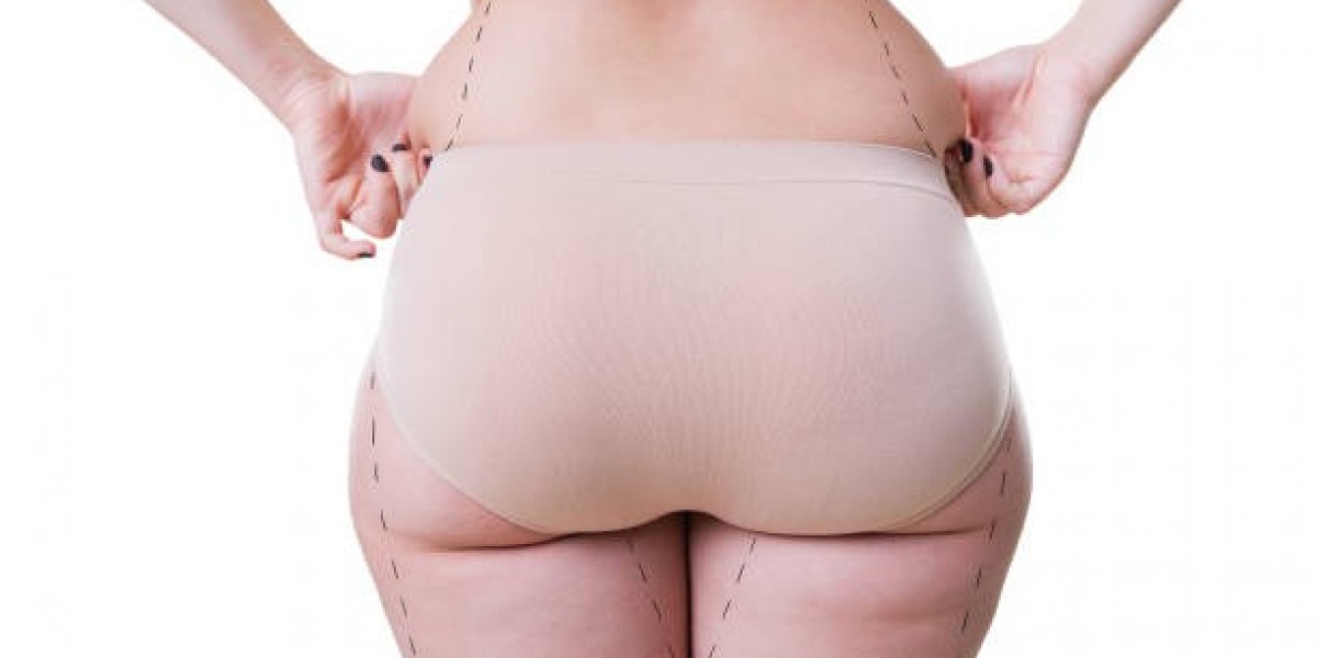 What Are the Possible Risks of Liposuction in Riyadh?