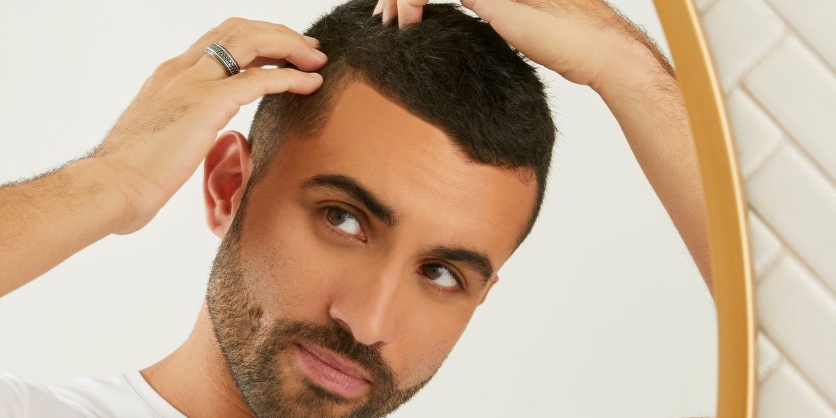 What to Expect After FUE Hair Transplant Treatment