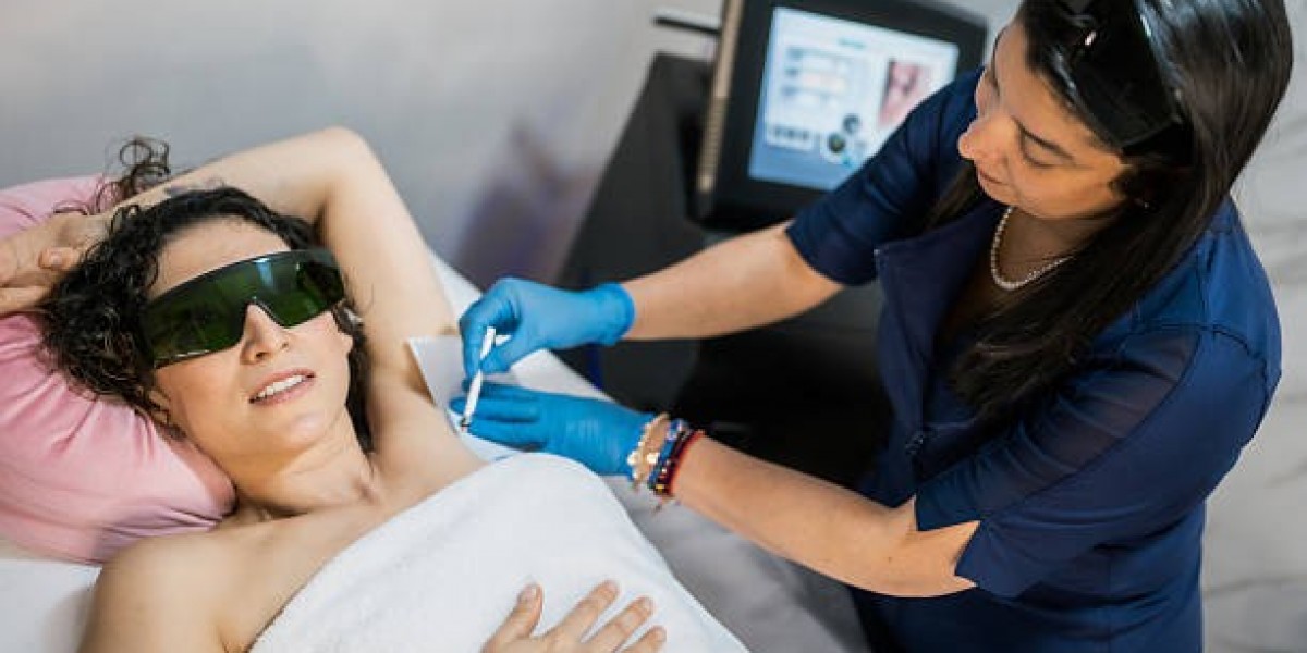 Laser Hair Removal for Long-Lasting Smooth Skin