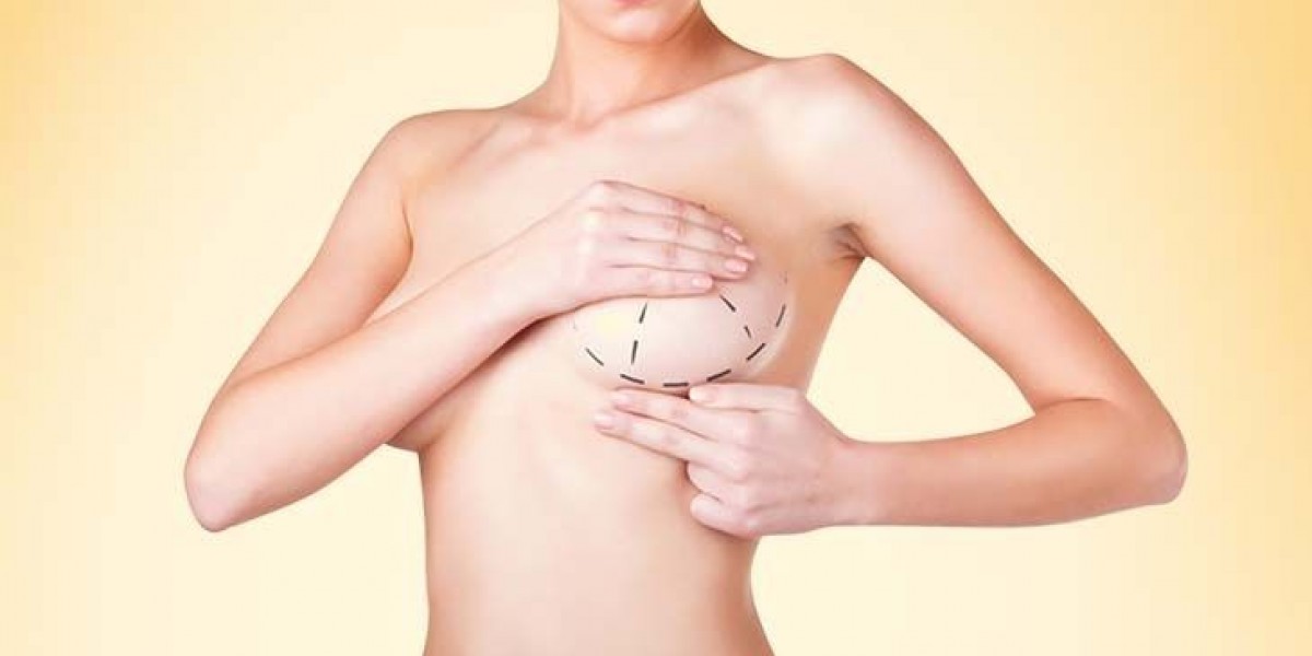 Best Plastic Surgeon in Dubai for Breast Augmentation Surgery – Dr. Anshu Plastic Surgeon