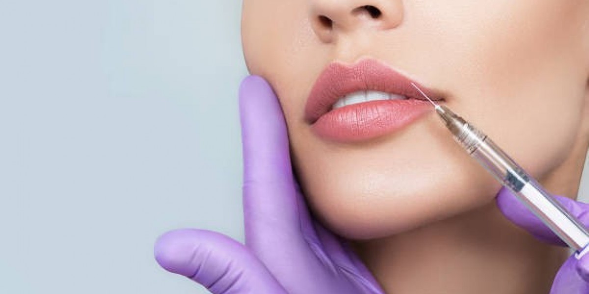 Lip Filler Injections and Overall Facial Harmony
