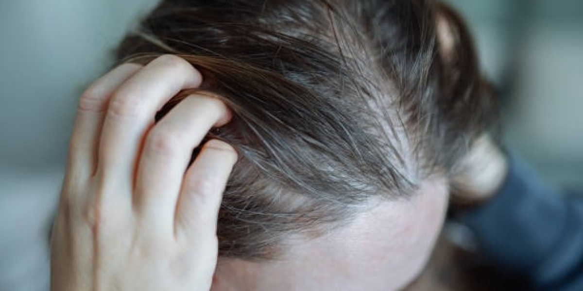 Hair Loss Treatment Solutions for Weak and Damaged Hair