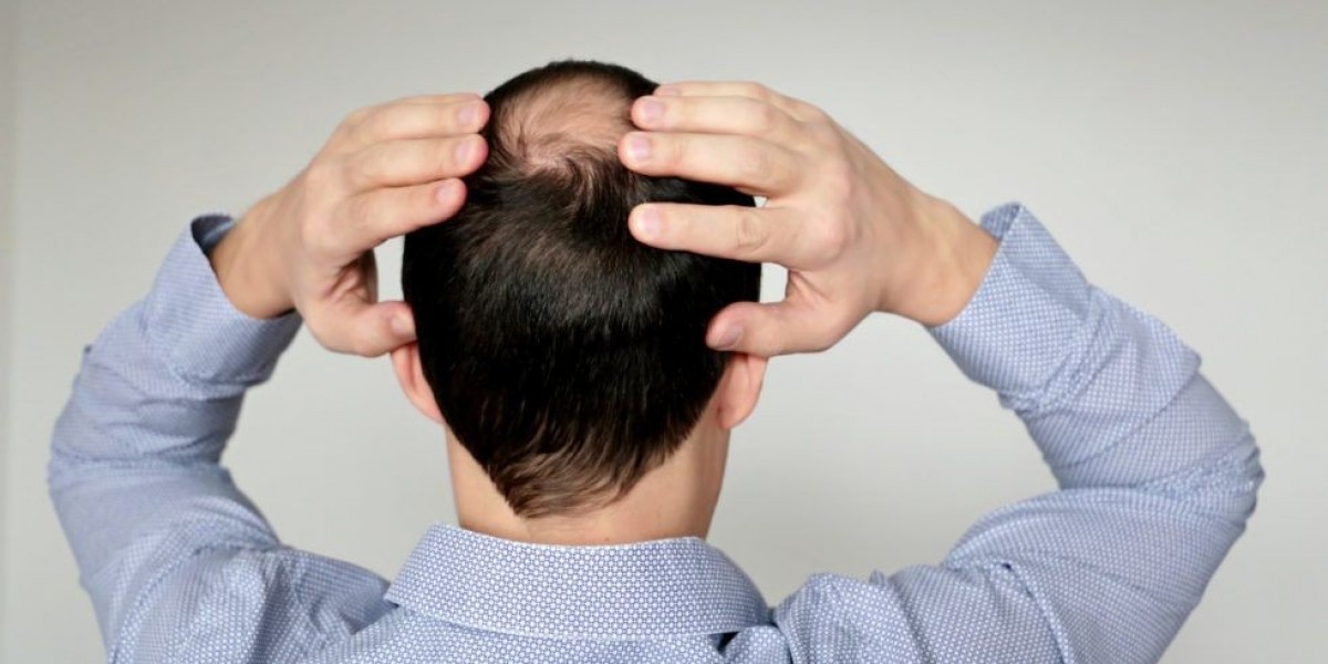 Hair Transplant Riyadh: Ramadan Iftar Energy Boost