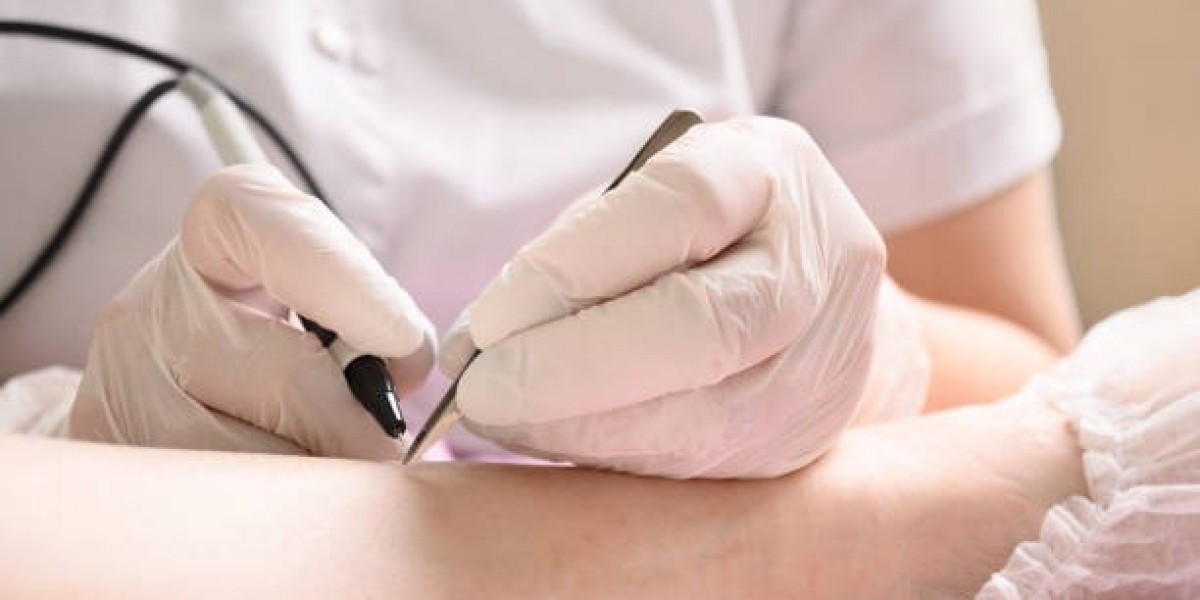 Permanent Hair Reduction You Can Rely On