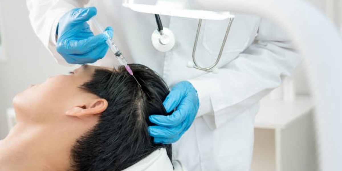 Why PRP Hair Treatment Is Chosen for Hair Strengthening