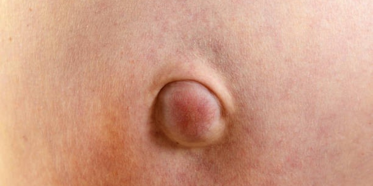 Understanding Hernia Surgery and Recovery Process