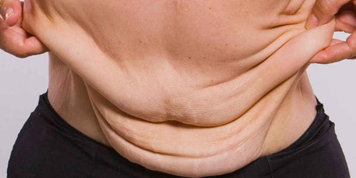 Bariatric Surgery in Islamabad: Nutritional Guidance Post-Surgery