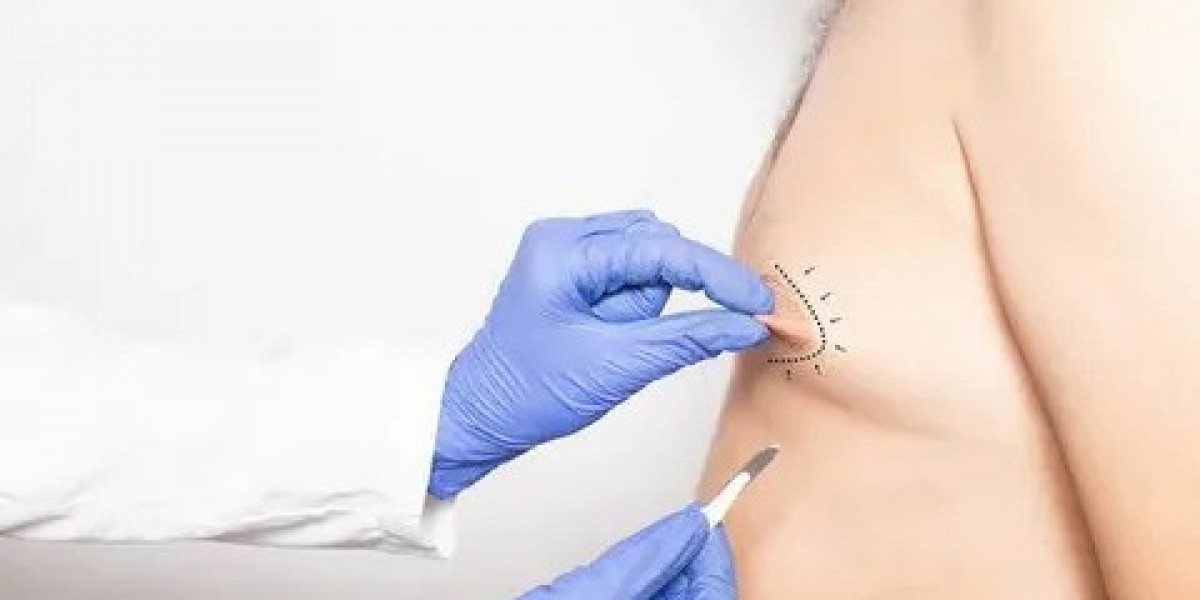 Gynecomastia in Islamabad: Safe Solutions for Men