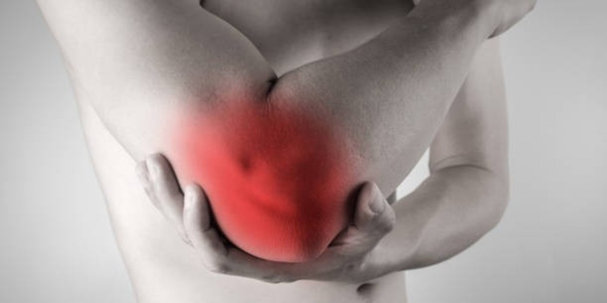 Fistula Surgery Indications and Eligibility