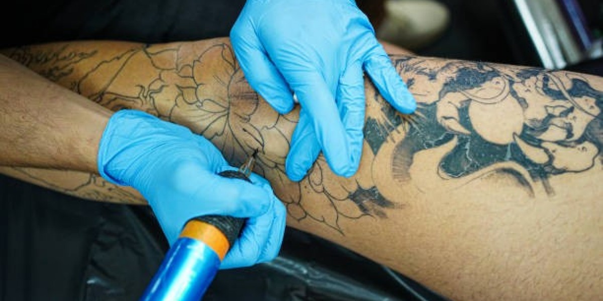 Optimizing Results from Laser Tattoo Removal