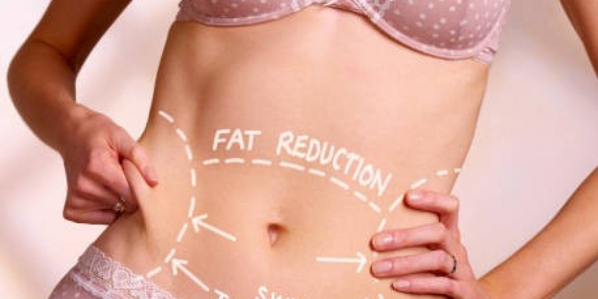 Liposuction and Fat Reduction Key Patient Insights