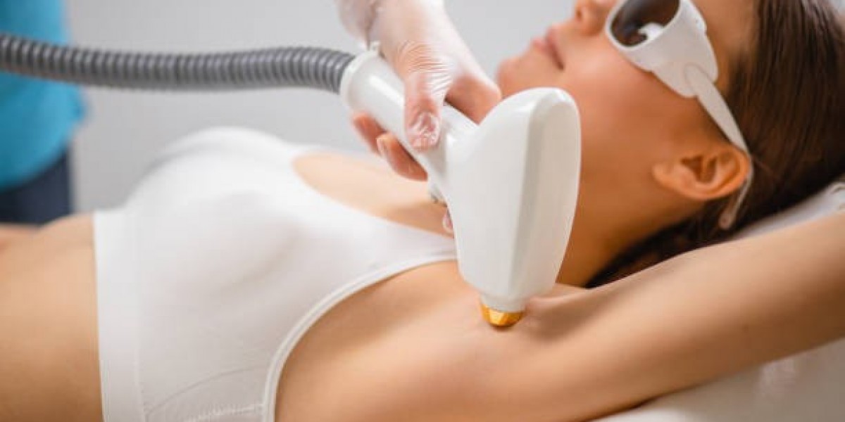 Can laser hair removal treat facial hair safely?