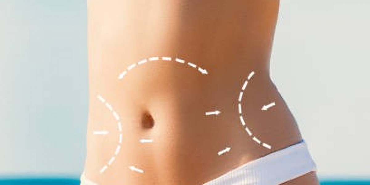 Liposuction Treatment Journey and Patient Experience