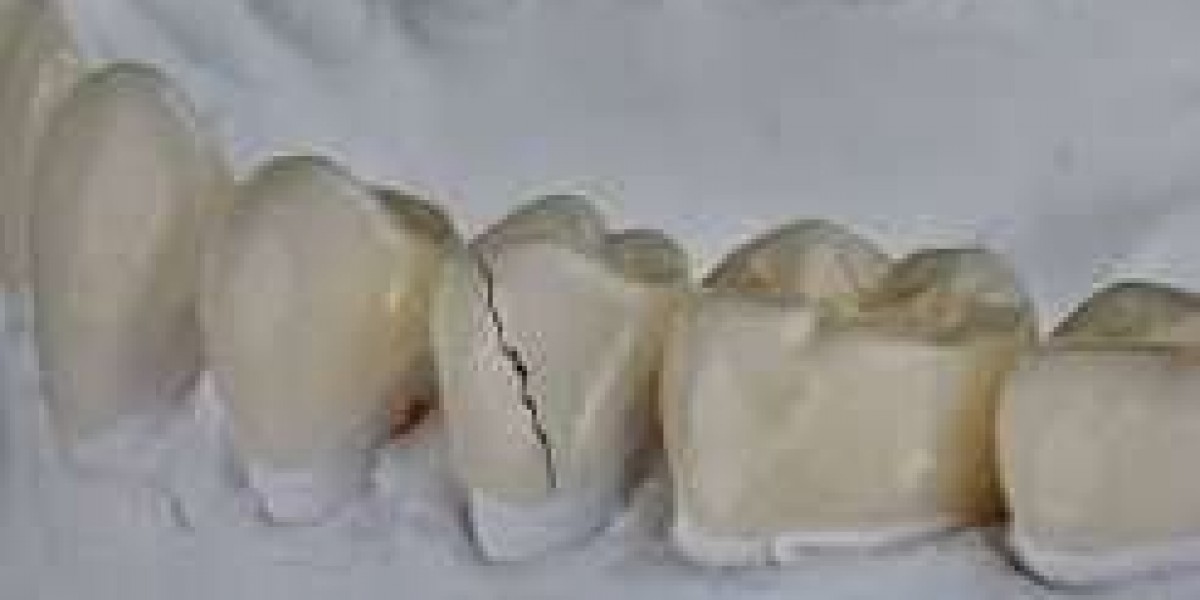 Can a Dental Crown Fix a Cracked Tooth? Here's What You Need to Know